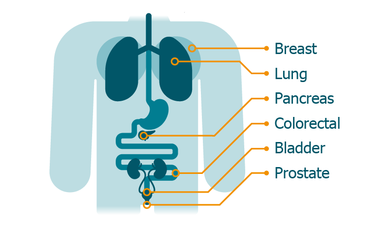Test Portfolio Organ Diagram